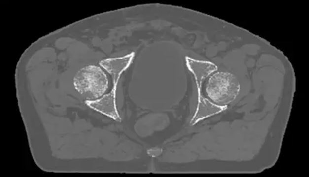 mr cat pelvis