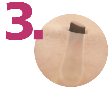 Wypadanie włosków po zabiegu depilatorem Philips Lumea.